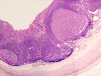 Нормальная и патологическая гистология лимфоидных тканей